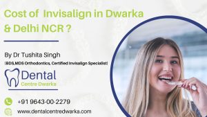 Read more about the article Cost  of  Invisalign in Dwarka