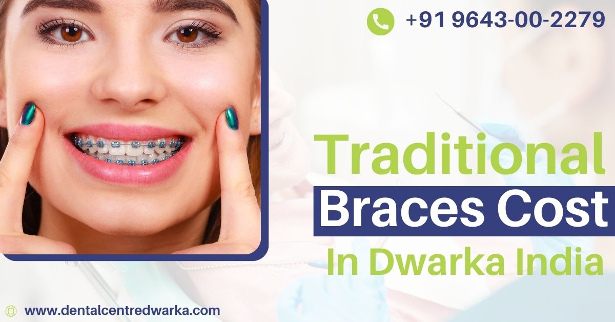 You are currently viewing Traditional Braces Cost In Dwarka, India