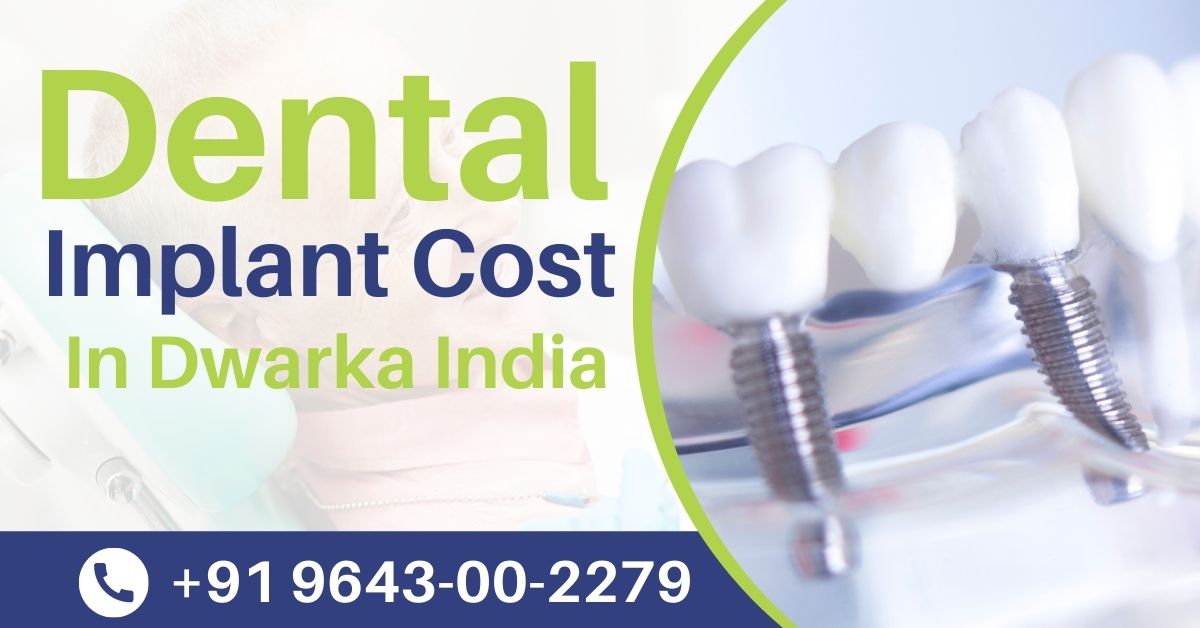 Read more about the article Dental Implant Cost In Dwarka India