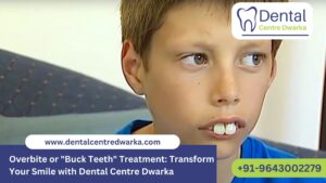 Read more about the article Overbite or “Buck Teeth” Treatment: Transform Your Smile with Dental Centre Dwarka